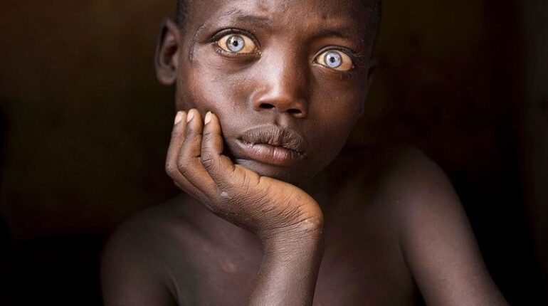 L’enfance dans différentes régions du monde sous l’objectif d’un photographe talentueux Ce photographe l’enfance monde montre à quoi ressemble photographe régions régions du monde santé santé famille santé femme santé France santé nutrition santé relax santé relaxe santé sécurité tranquillité