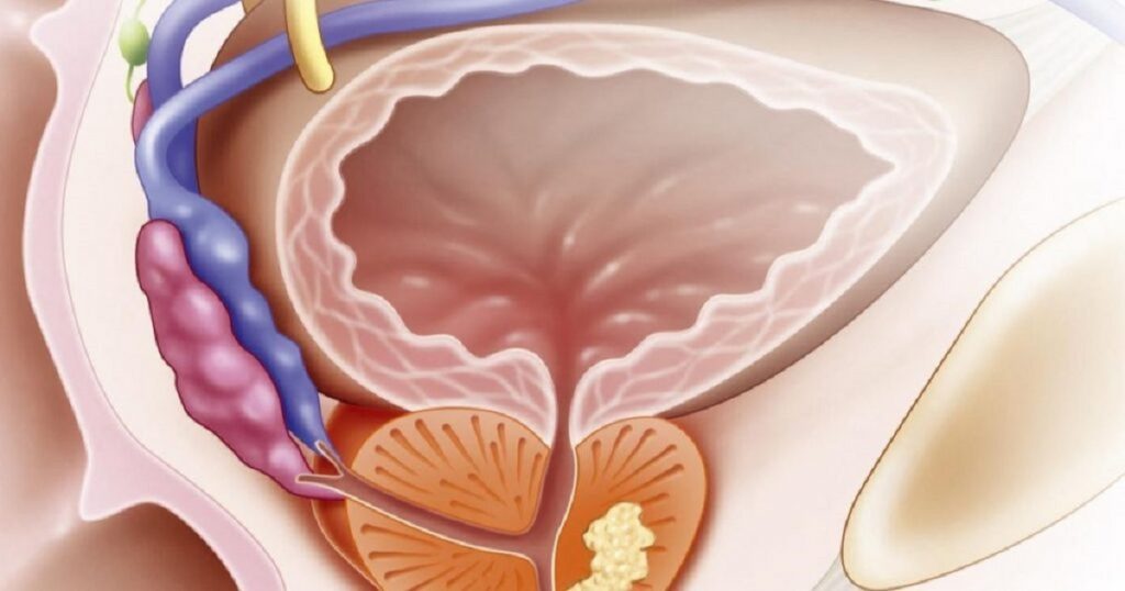 Les symptômes alarmants du
