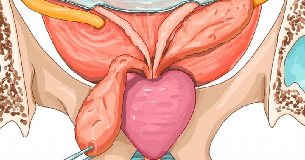 Les symptômes alarmants du