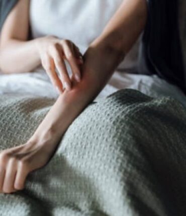 Urticaire ? Allergie ? Tout son corps la démangeait, le diagnostic alarmant que les médecins ont découvert