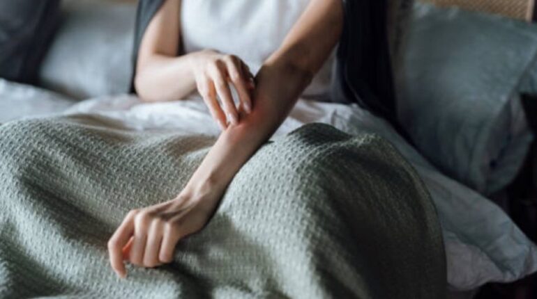 Urticaire ? Allergie ? Tout son corps la démangeait, le diagnostic alarmant que les médecins ont découvert allergie à l'eau allergie adolescence allergie rare démangeaisons dermatologue Flávia Leonel Santana influenceuse irritation peau maladie incurable symptômes allergie témoignage traitement allergie urticaire urticaire aquagénique yoga