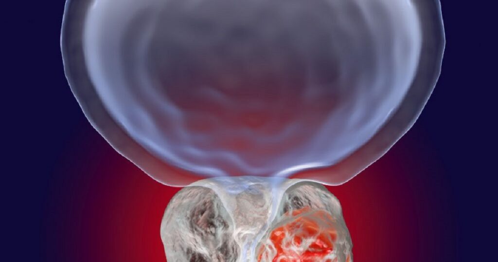 Les symptômes alarmants du