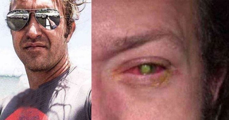 Il devient aveugle après