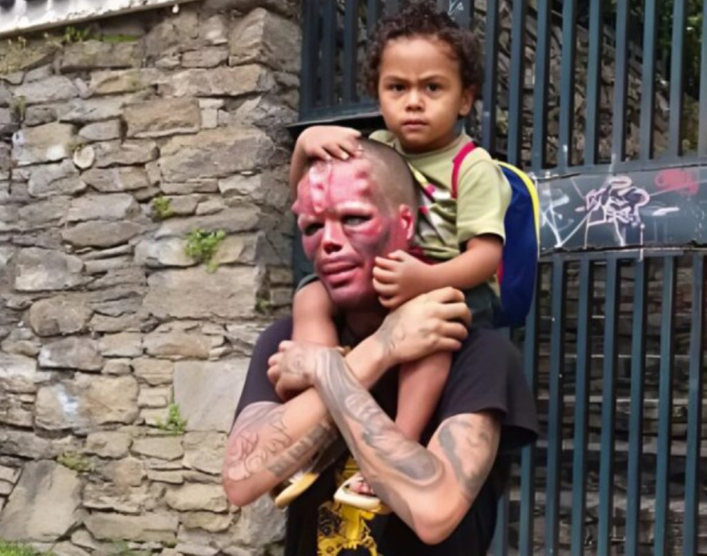 Un homme s’est coupé