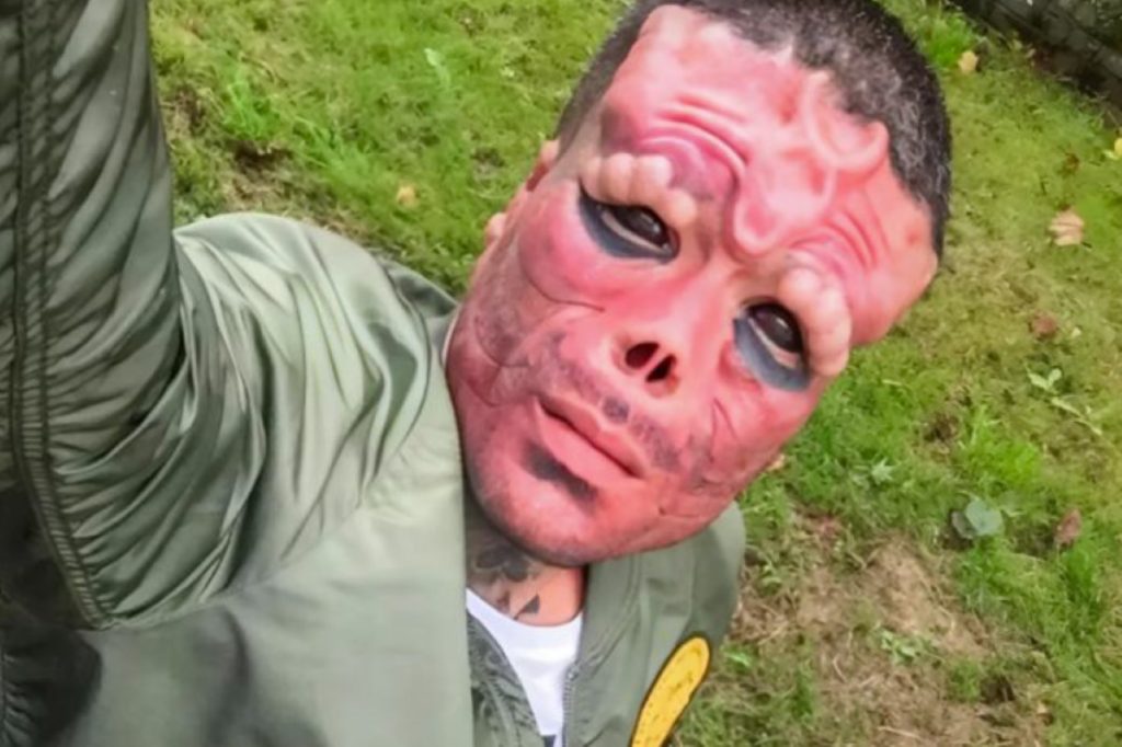 Un homme s’est coupé