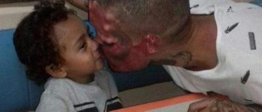 Un homme s’est coupé