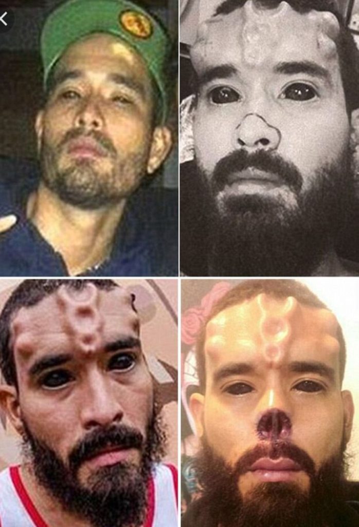 Un homme s’est coupé