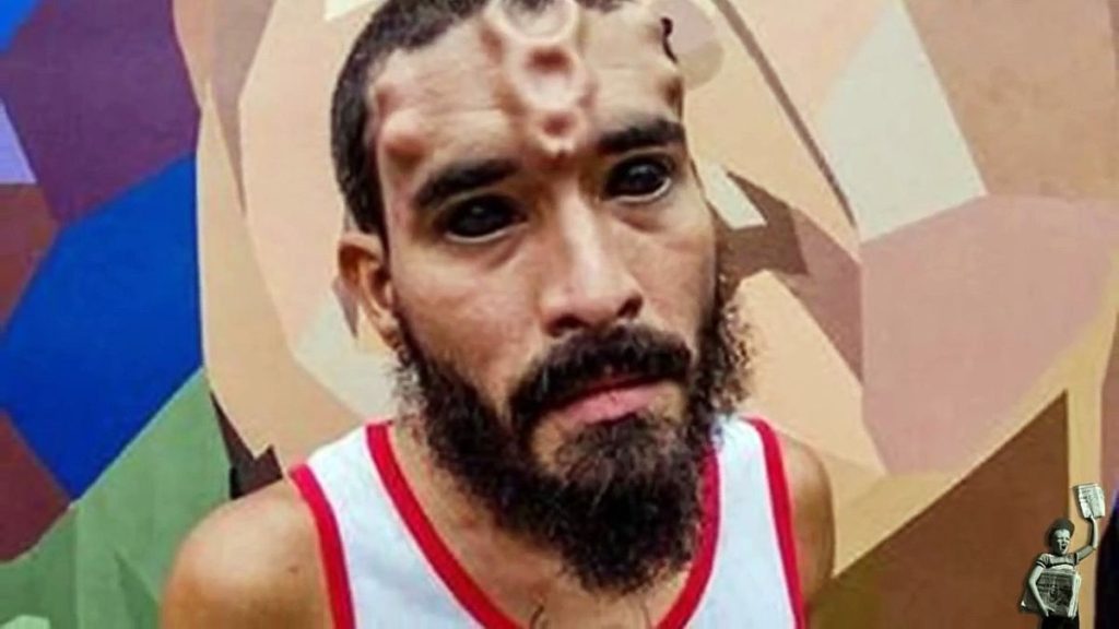 Un homme s’est coupé