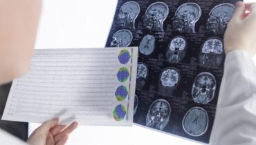 Six ans après, plus aucune trace : la guérison exceptionnelle de Lucas fait l’objet d’une étude approfondie