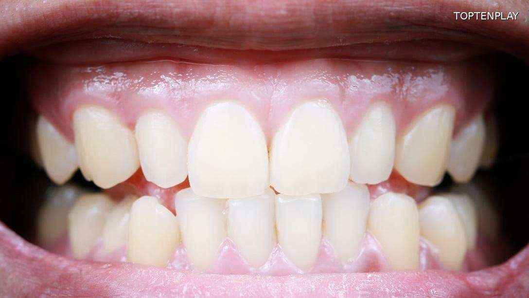 Image d'illustration © TopTenPlay