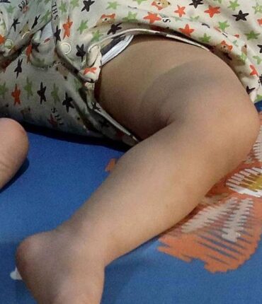 Assistante maternelle de 47 ans : elle avoue enfin avoir cassé les jambes et le bras du petit Mathys