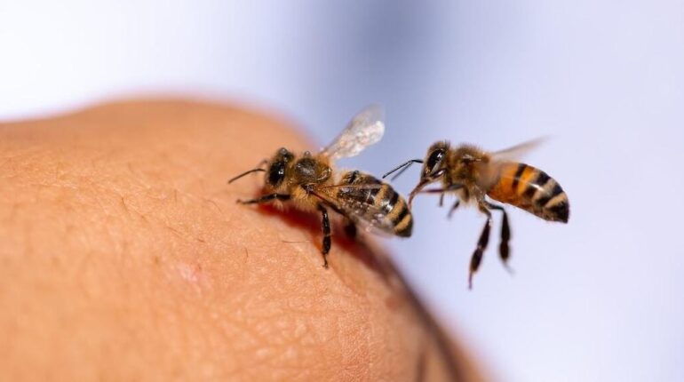 Physicienne condamnée par Lyme, elle guérit après une attaque d’abeilles : « En 4 jours, mes analyses ont révélé… » Apithérapie Guérison Maladie de Lyme Mélittine Ministère de la Santé recherche médicale Venin d'abeille