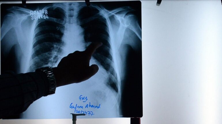 allaité trois enfants Boissons énergisantes contrôles de sécurité hôpital Radiologie Radioprotection Rayons X