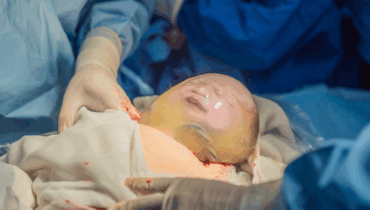 Allaiter son bébé allergie rare Congé maternité connaissances Naissance Coiffée Sage-femme