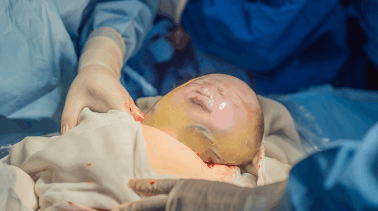 La réaction bouleversante des sages-femmes en découvrant le petit Rio : « On n’avait jamais vu ça… » Allaiter son bébé allergie rare Congé maternité connaissances Naissance Coiffée Sage-femme