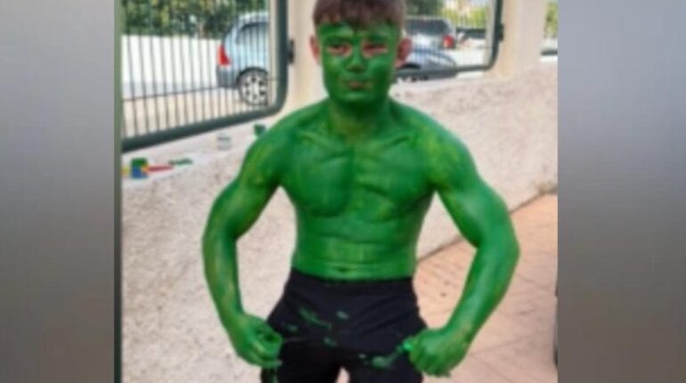 En vacances à Benidorm, Kane a une idée géniale : « 6 couches de peinture textile, ça partira forcément… » Benidorm Camp de vacances Communauté gens du voyage déguisement Hulk Hogan Mésaventure Peinture