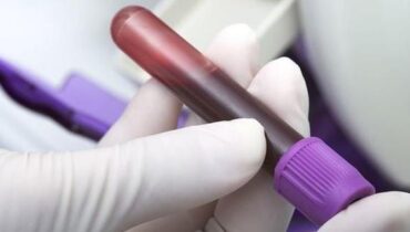 Cancer du poumon dépistage cancer diagnostic précoce recherche médicale Thérapies ciblées