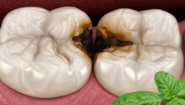 Basilic sacré mauvaise haleine Plantes médicinales santé bucco-dentaire Soins des gencives Tulsi