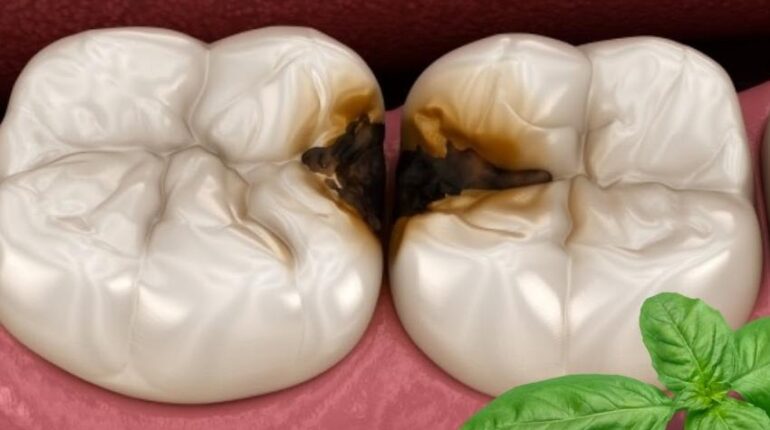 Basilic sacré mauvaise haleine Plantes médicinales santé bucco-dentaire Soins des gencives Tulsi