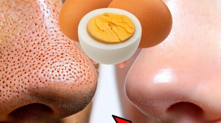 beauté maison masque visage peau nette points noirs Remèdes naturels Soins de la peau