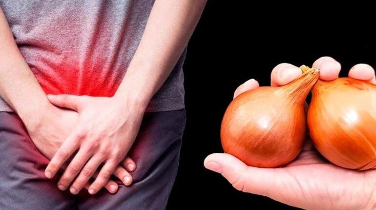 Confort urinaire : comment la quercétine de l’oignon soulage naturellement la prostate et la vessie Ail et oignon cancer de la prostate Quercétine Remèdes naturels Santé urinaire Vessie