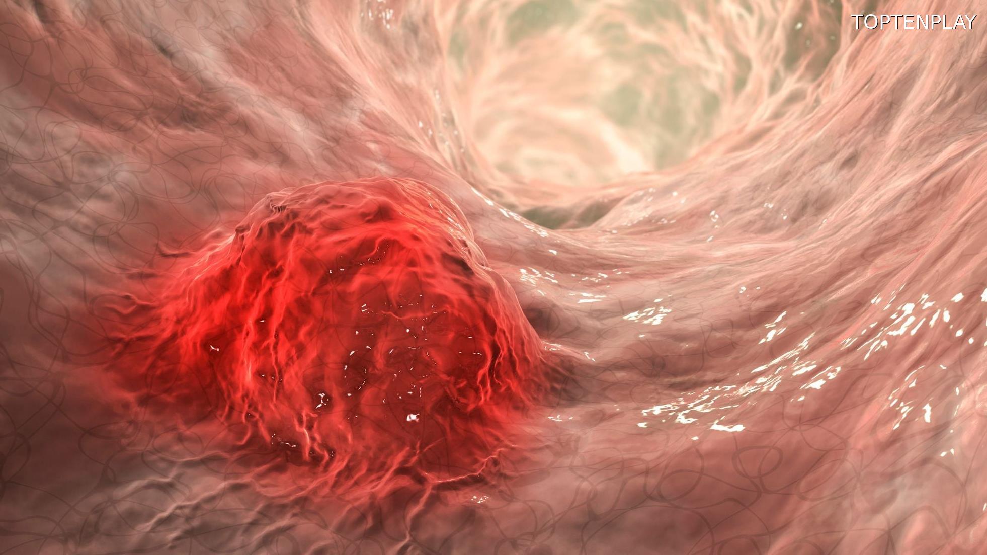 Image d'illustration © TopTenPlay