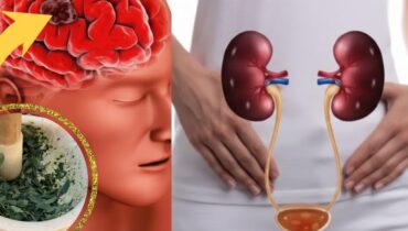 Bienfaits naturels Chanca Piedra Digestion Plantes Amazoniennes Santé Hépatique Santé Rénale système immunitaire