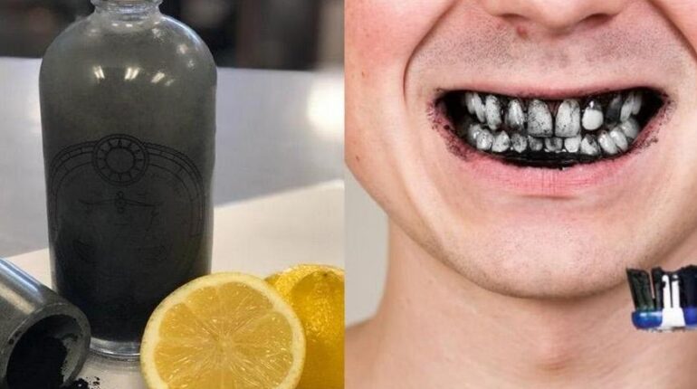 Bienfaits santé Charbon actif citron Cosmétiques DIY cleaning Soins dentaires Zénith d'Angers