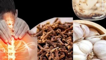 bien être Clous de girofle Huile d'ail Jambes lourdes Remèdes naturels Soins à domicile Varices