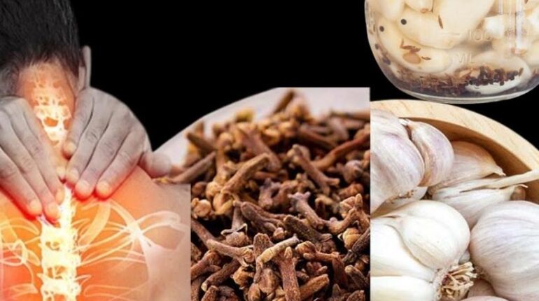 bien être Clous de girofle Huile d'ail Jambes lourdes Remèdes naturels Soins à domicile Varices