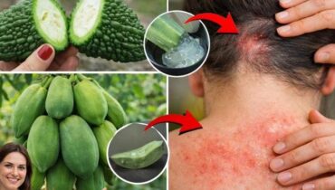 Beauté naturelle bien être Fongiques Irritations cutanées Remèdes maison Soins de la peau