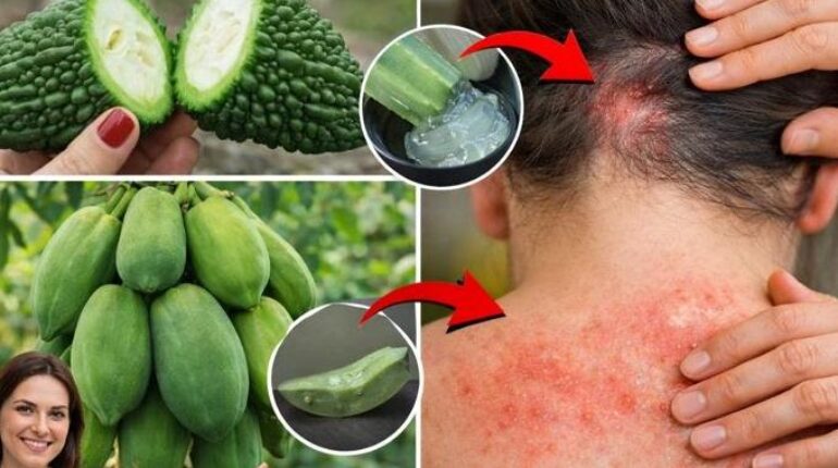 Beauté naturelle bien être Fongiques Irritations cutanées Remèdes maison Soins de la peau