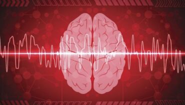 Algorithme AVC Boissons énergisantes diagnostic Imagerie Cérébrale Innovations Technologie médicale