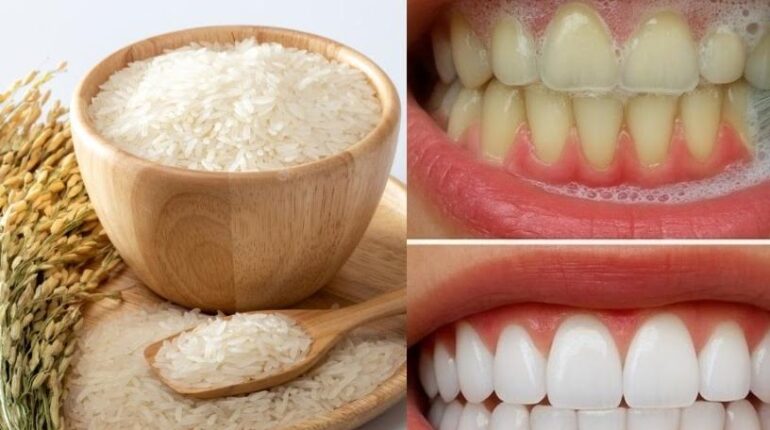 Blanchiment dents Eau de riz Haleine fraîche Hygiène dentaire Remèdes naturels Soins bucco-dentaires