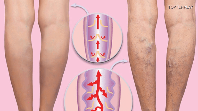 Symbolbild © TopTenPlay