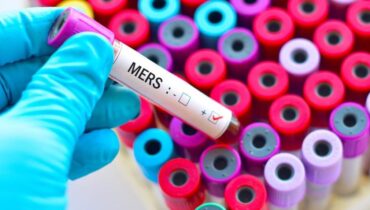 accusent la France Boissons énergisantes Coronavirus épidémie MERS-CoV Santé Publique