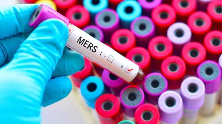 accusent la France Boissons énergisantes Coronavirus épidémie MERS-CoV Santé Publique