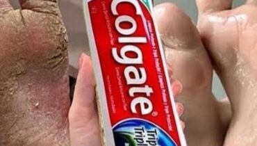 20 astuces Beauté Hygiène alimentaire Remèdes maison Soins des pieds Talons craquelés