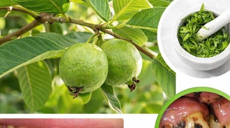 Feuilles de goyave Gencives saines Haleine fraîche Hygiène bucco-dentaire Remèdes naturels santé bucco-dentaire