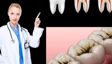 Blanchiment dentaire Clous de girofle Hygiène bucco-dentaire Laurier Remèdes naturels Soins dentaires