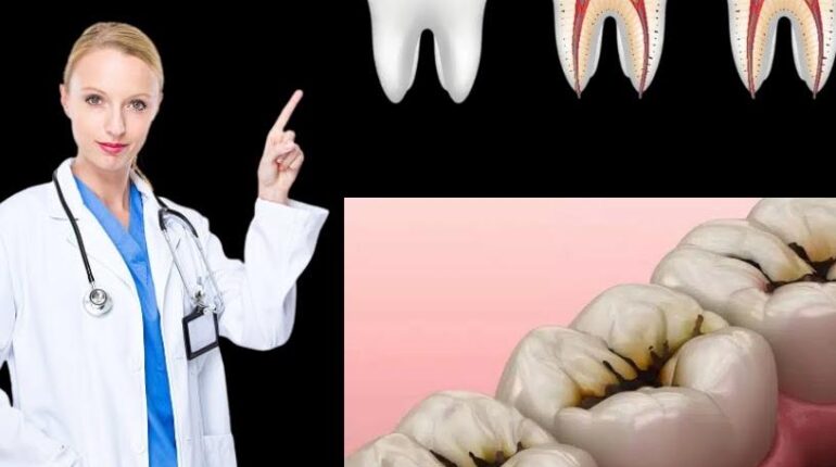 Laurier et clous de girofle : comment ces deux épices courantes polissent l’émail et réduisent les taches dentaires Blanchiment dentaire Clous de girofle Hygiène bucco-dentaire Laurier Remèdes naturels Soins dentaires