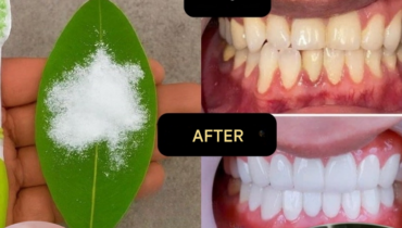 Blanchiment des dents Feuilles de goyave Haleine fraîche Hygiène dentaire Remèdes maison Soins naturels