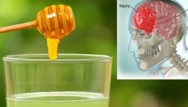 Accident du travail bien être citron Gingembre Immunité Miel bio Remèdes naturels