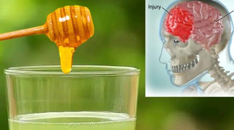 Accident du travail bien être citron Gingembre Immunité Miel bio Remèdes naturels