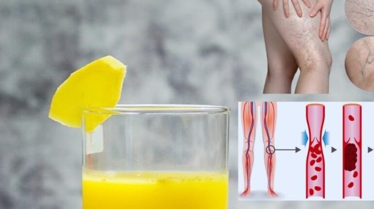 bien être citron Gingembre Immunité Infusions Moringa Vitalité