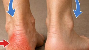 Beauté naturelle Déshydratation Peau sèche Remèdes naturels Soins des pieds Talons secs