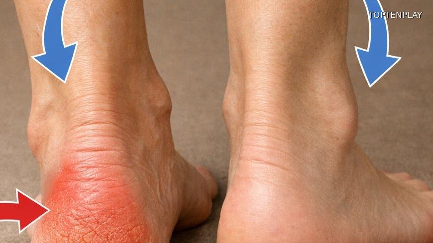 Symbolbild © TopTenPlay