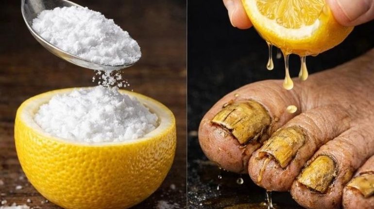 Bain de pieds Cake au citron Callosités Hygiène alimentaire Odeurs Remèdes naturels Soins des pieds 