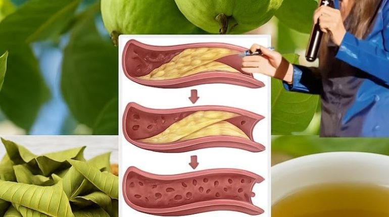 Bienfaits des plantes diabète Feuilles de goyave glycémie insuline Santé naturelle 