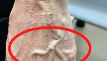 Bienfaits santé Circulation sanguine Consultation médicale Physiologie symptômes Veines